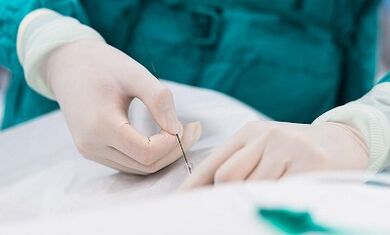 Diagnosticul venelor varicoase ale unui pelvis mic
